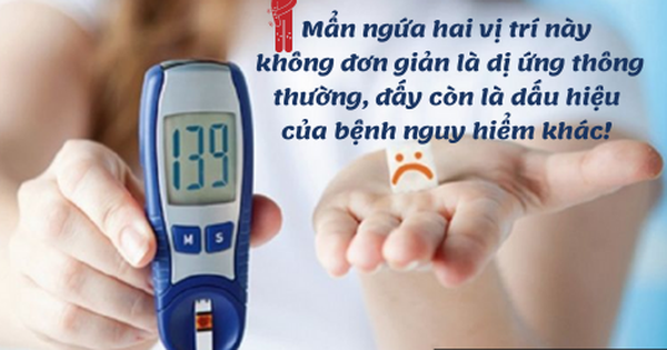 2 vị trí ngứa ngáy là dấu hiệu đường huyết tăng cao, bệnh tiểu đường rình rập: Tuyệt đối đừng chủ quan!