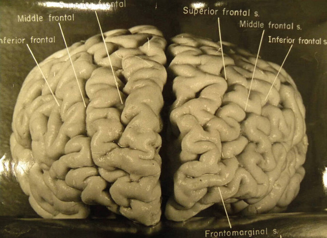  Chuyến phiêu lưu của bộ não Albert Einstein, người có IQ cao nhất thế giới sau khi nó bị đánh cắp khỏi cơ thể - Ảnh 1.