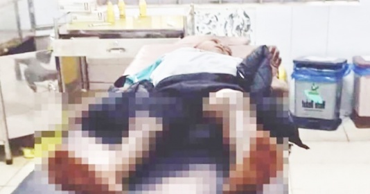 Điều tra nghi án bé trai bị tẩm xăng đốt hai chân tại Đắk Lắk