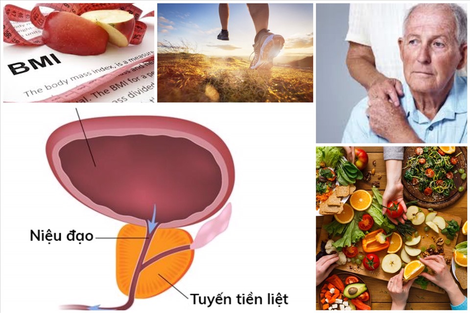 Giải pháp ngăn ngừa ung thư tuyến tiền liệt ở nam giới