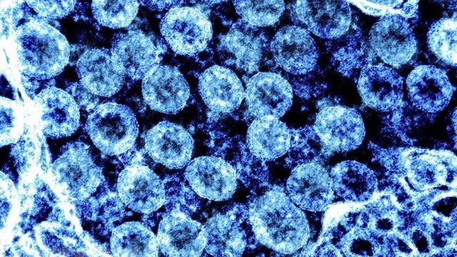 Phát hiện mới về khả năng lây lan của virus SARS-CoV-2