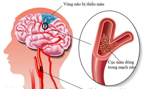 ph226n-biet-dot-quy-v224-co-giat_1.png