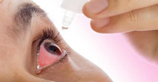 Quảng Nam tăng cường phòng chống bệnh đau mắt đỏ