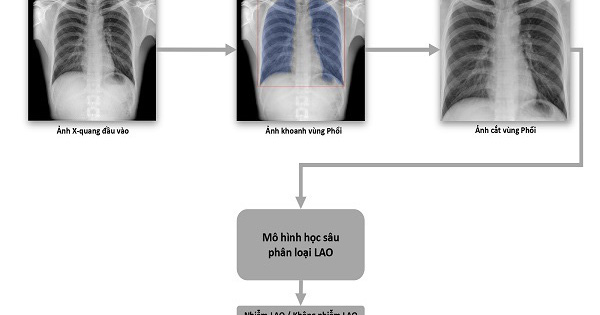 VinBrain và FIT phát hành sách trắng về ứng dụng trí tuệ nhân tạo cho chẩn đoán và tầm soát bệnh lao