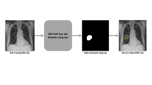 VinBrain và FIT phát hành sách trắng về ứng dụng trí tuệ nhân tạo cho chẩn đoán và tầm soát bệnh lao - Ảnh 1.